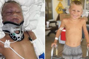 Egy 6 éves kisfiú súlyosan megsérült, miután elgázolta egy 8 tonnás buldózer – pár nap múlva már elkezdett járni