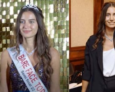 A Miss Anglia döntőse smink nélkül indul a szépségversenyen, ezzel nagy beszélgetést indít el a szépségnormákról