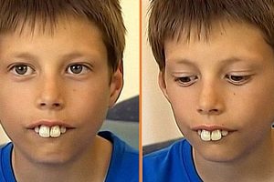 A fiú, akit a feltűnő foghibája miatt zaklattak, új mosolyt kapott az idegenek kedvességének köszönhetően