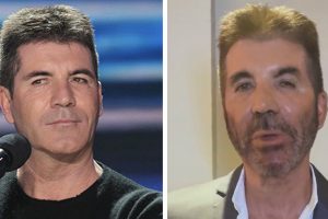 Simon Cowell új külseje miatt plasztikai műtétről és botoxról beszélnek az emberek