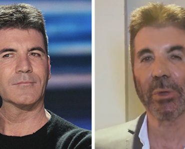 Simon Cowell új külseje miatt plasztikai műtétről és botoxról beszélnek az emberek