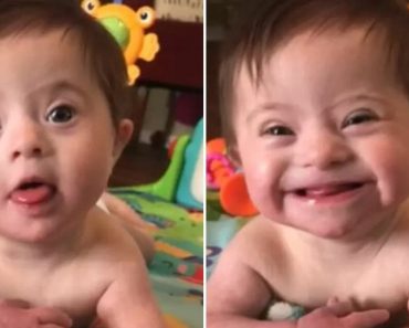 Az örökbefogadott Down-szindrómás kislány milliók szívét olvasztja el, miután megmutatta örökbefogadó anyukájának az “új mosolyát”