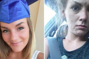 A fiatal nő legyőzte a heroin- és metamfetaminfüggőséget, és megkapta a diplomáját, most képekben osztja meg az útját