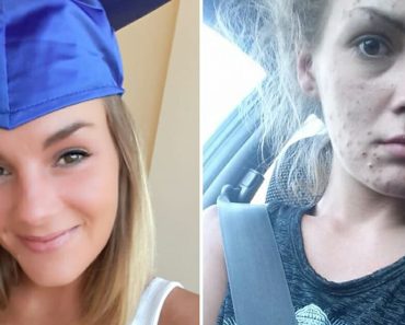 A fiatal nő legyőzte a heroin- és metamfetaminfüggőséget, és megkapta a diplomáját, most képekben osztja meg az útját