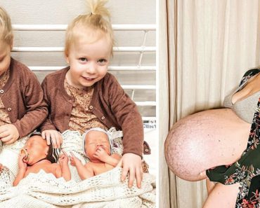 Az anya ikrek után hármas ikreknek ad életet, és megmutatja hihetetlen babapocakját
