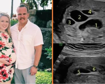 A terhes nő elmegy ultrahangra — 6 fekete kört lát a babája körül a képernyőn