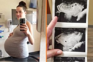 Az anyuka boldogan tudta meg, hogy ötös ikrekkel terhes — az orvos azt mondja, meg kell szakítania a terhességet