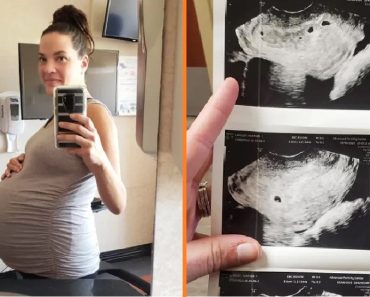 Az anyuka boldogan tudta meg, hogy ötös ikrekkel terhes — az orvos azt mondja, meg kell szakítania a terhességet