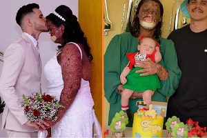 A férfi figyelmen kívül hagyja, hogy az emberek „szörnyetegnek” nevezik szerelmét, feleségül veszi és elfogadja 3 gyerekét sajátjaként
