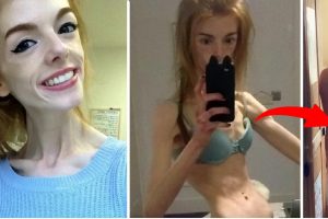 Ez a nő 5 évig naponta csak 1 szelet kenyeret evett – de nézz rá ma!