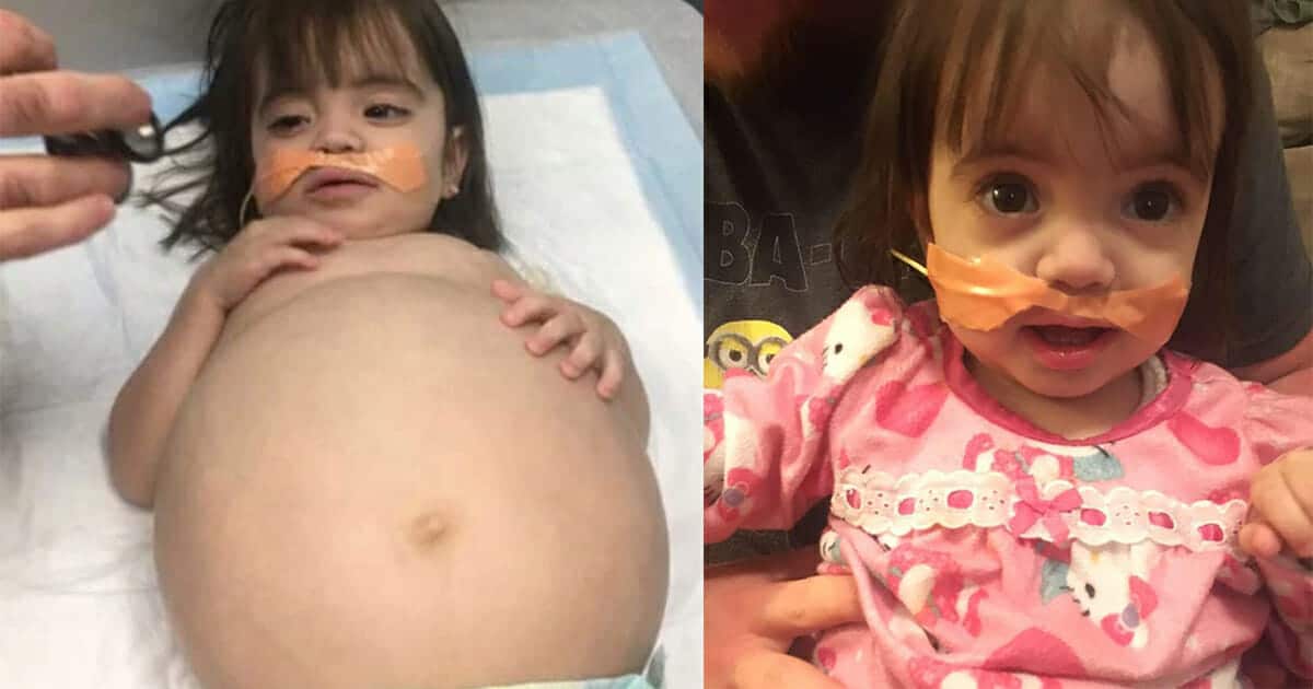 Ez a baba 8 hónapos terhesnek tűnt egy halálos betegség miatt
