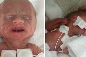 A 450 grammal született kislány 4 hónap után elhagyja a kórházat – tapsoljuk meg a bátor harcost!