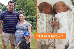 Egy nő egy hónap alatt kétszer esett teherbe, és 2 különböző súlyú babát szült – 3 év után egyformának tűnnek