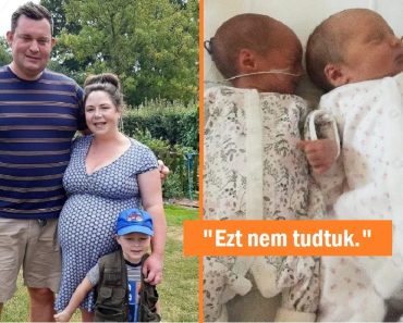 Egy nő egy hónap alatt kétszer esett teherbe, és 2 különböző súlyú babát szült – 3 év után egyformának tűnnek