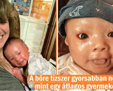 Az anya örökbe fogadott egy „ijesztőnek” és „égetettnek” titulált kislányt – most egy drága hercegnő lett belőle