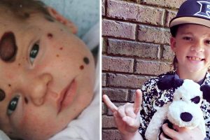 Dylan csodálatos utazása: A fiú, aki annyiszor bebizonyította, hogy orvosai tévednek