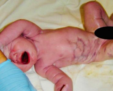 Az anya megszüli gyermekét, nem engedik, hogy elvigye a babát, és az apa azt mondja, hogy „valami nincs rendben a lábával” Az anya megszüli gyermekét, nem engedik, hogy elvigye a babát, és az apa azt mondja, hogy „valami nincs rendben a lábával”