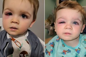 Az anyuka figyelmeztetést ad ki, miután a babája majdnem elvesztette a látását egy fürdőjáték miatt