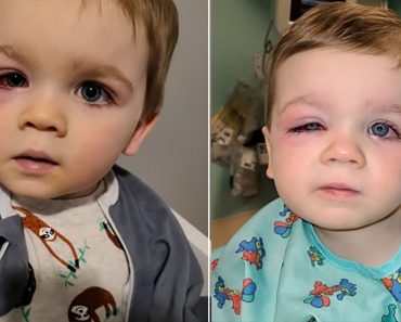 Az anyuka figyelmeztetést ad ki, miután a babája majdnem elvesztette a látását egy fürdőjáték miatt Az anyuka figyelmeztetést ad ki, miután a babája majdnem elvesztette a látását egy fürdőjáték miatt