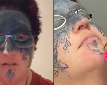 Egy nőnek, akinek az arcát „akarata ellenére” tetoválták, „megváltozott” az élete, miután egy idegen felajánlotta, hogy segít az eltávolításban