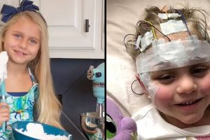 Egy 7 éves kislánynál demenciát diagnosztizáltak egy rutin szemvizsgálat után