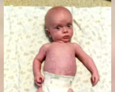 A szülők befogadják a megrázott baba szindrómás fiút, és teljesen megváltoztatják az életét.